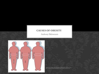 CAUSES OF OBESITY
  Anthony Delorenzis




       Victovoi, 2010, Obesity-waist_circumfrence, Febuary 14, 2012. Retrieved from
       http://commons.wikimedia.org/wiki/File:Obesity-waist_circumference.svg
 