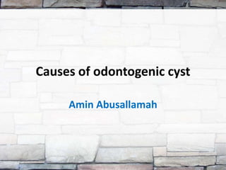 Causes of odontogenic cyst

     Amin Abusallamah
 