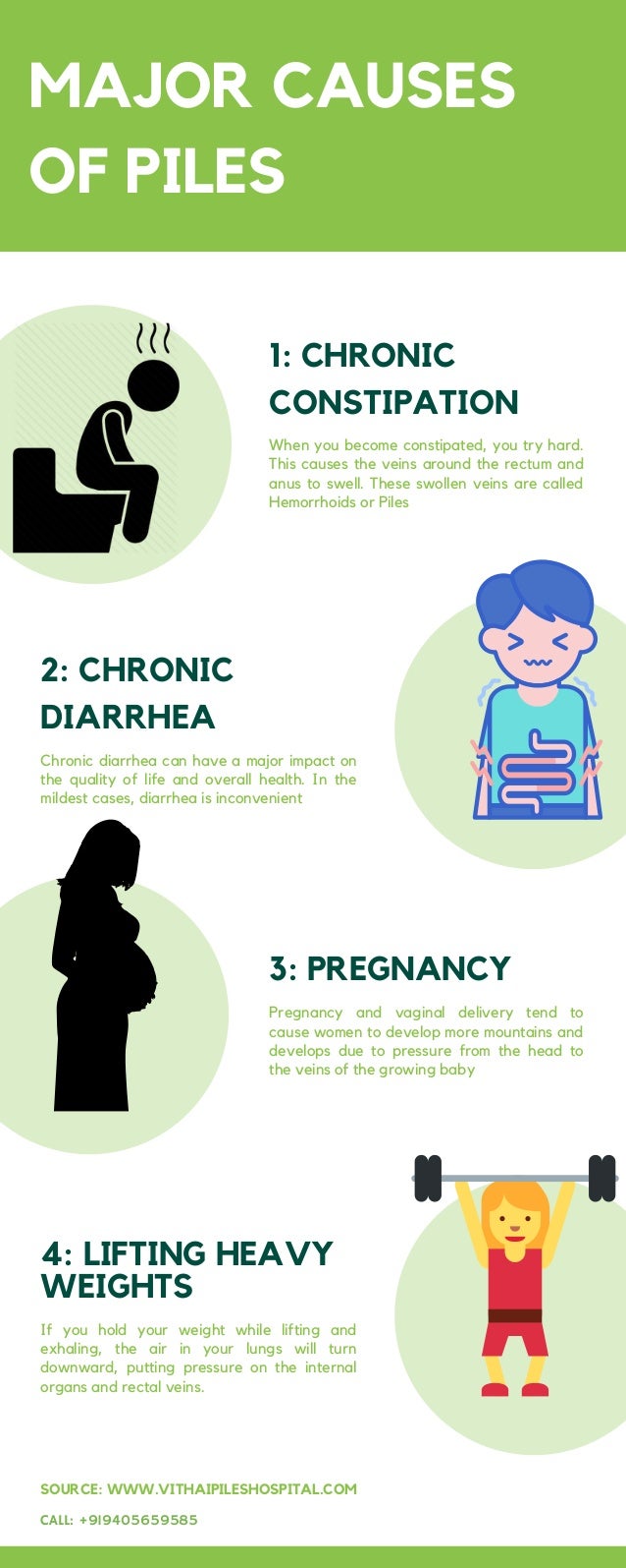 What Causes Piles Uk At Marie Vicente Blog What Causes Piles Uk At Marie Vicente Blog
