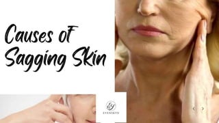 Causes of Sagging Skin