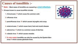 Causes of tonsillitis :-
Note:- Most cases of tonsillitis are caused by a viral infection.
Viruses known to cause tonsillitis include:
1- rhinoviruses  which cause the common cold.
2- influenza virus
3- parainfluenza virus  which causes laryngitis and croup
4- enteroviruses  which cause hand, foot and mouth disease
5- adenovirus  which is a common cause of diarrhea
6- rubeola virus  which causes measles
7- In rare cases tonsillitis can also be caused by the Epstein-Barr
virus which causes glandular fever.
 