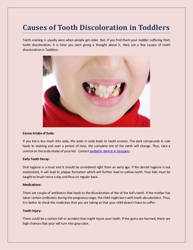 What Causes Teeth Discoloration In Babies And Toddler vrogue.co