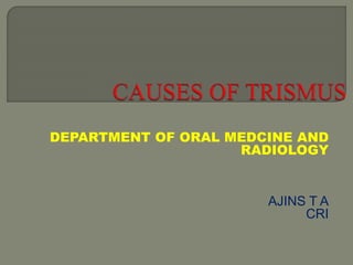 DEPARTMENT OF ORAL MEDCINE AND
RADIOLOGY
AJINS T A
CRI
 