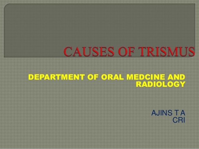 causes of trismus trismus
