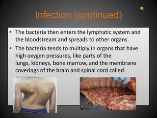 Infection (continued)
• The bacteria then enters the lymphatic system and
  the bloodstream and spreads to other organs.
• The bacteria tends to multiply in organs that have
  high oxygen pressures, like parts of the
  lungs, kidneys, bone marrow, and the membrane
  coverings of the brain and spinal cord called
  meninge.
    Tuberculosis in the spine     TB infected deer lung
 