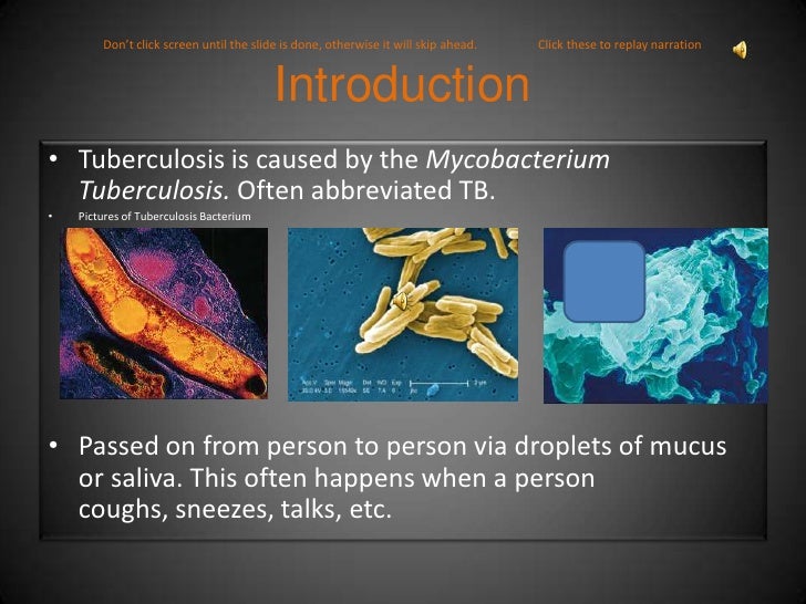 seminar presentation on tuberculosis