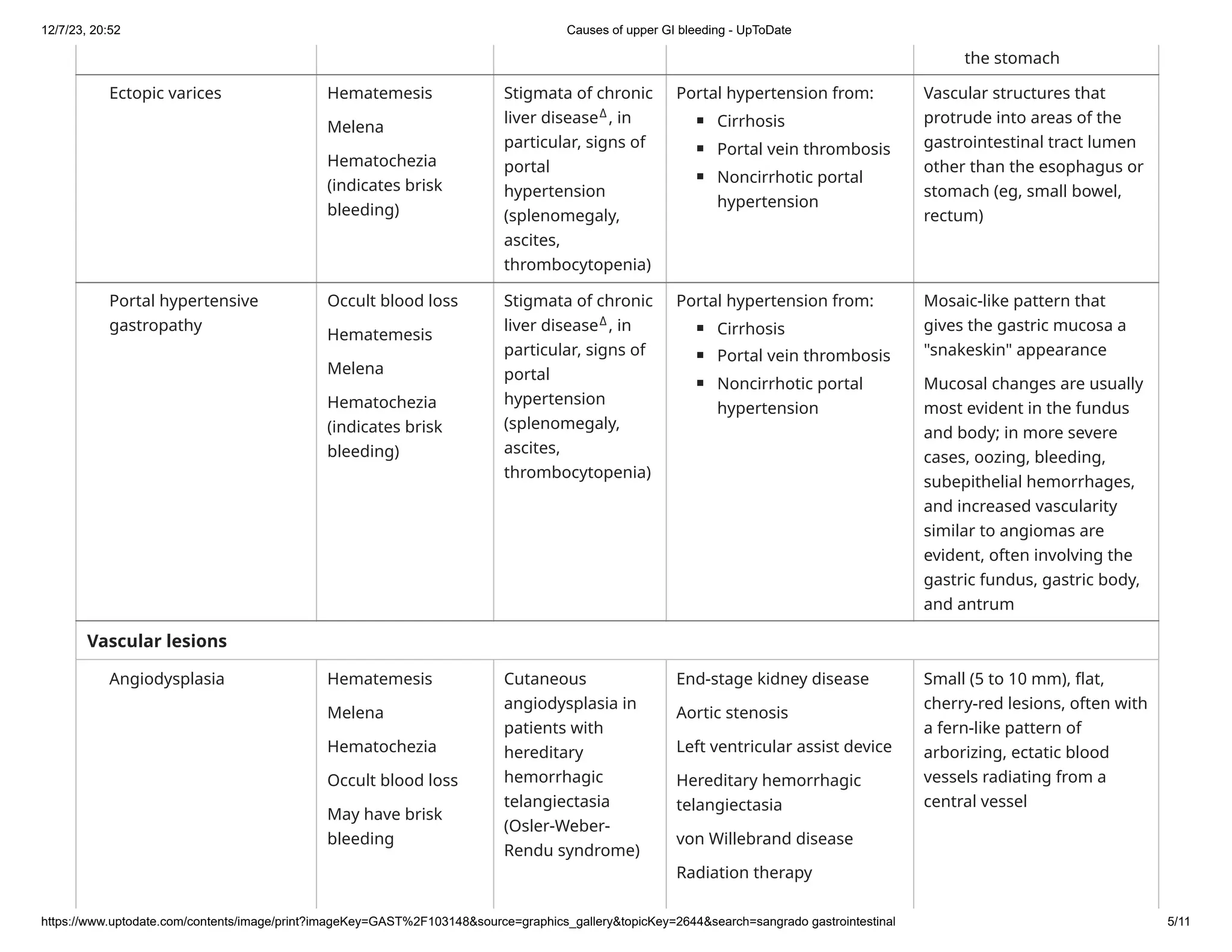Causes of upper GI bleeding - UpToDate.pdf