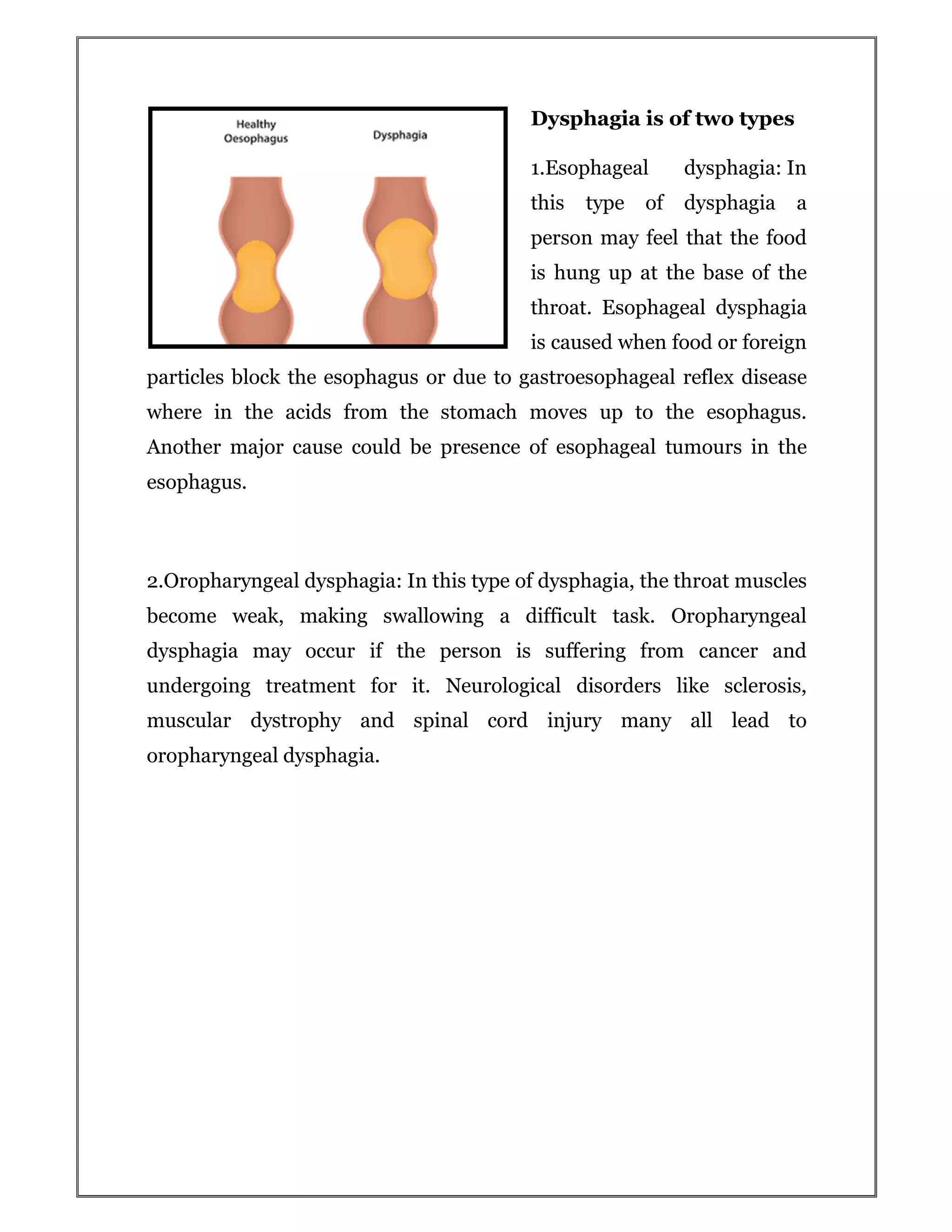 Causes Symptoms Of Dysphagia Pdf
