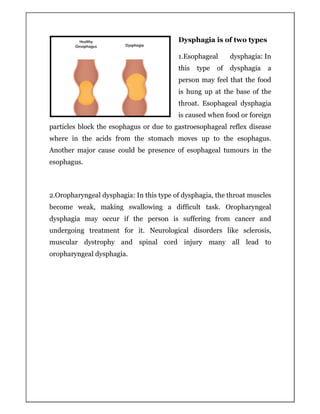 Causes & symptoms of dysphagia | PDF
