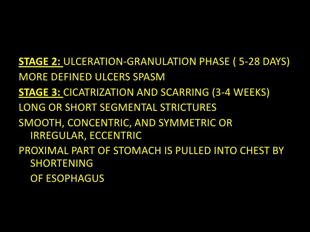 Caustic esophagitis