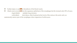 ● Further injury is caused by thrombosis of the blood vessels.
● Alkalis most severely affects the squamous epithelium of the oesophagus but the stomach only 20% of cases.
- liquid alkalis multiple long strictures
- solid alkalis short dense, often localised at the levels of the carina or the aortic arch, an
anatomically narrow part of the oesophagus where impaction of solid occurs.
 