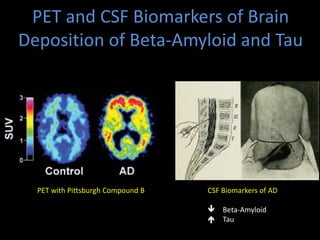 The glymphatic system in sleep and neurodegenerative diseases | PPTX