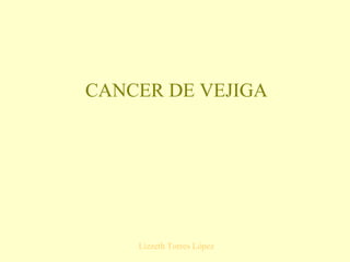 CANCER DE VEJIGA Lizzeth Torres López 