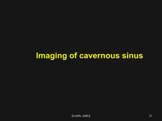 Imaging of cavernous sinus
27Dr.GPK, OMFS
 