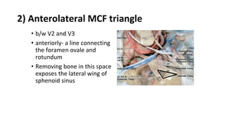 2) Anterolateral MCF triangle
• b/w V2 and V3
• anteriorly- a line connecting
the foramen ovale and
rotundum
• Removing bone in this space
exposes the lateral wing of
sphenoid sinus
 