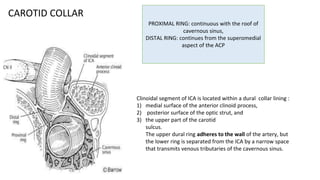 PROXIMAL RING: continuous with the roof of
cavernous sinus,
DISTAL RING: continues from the superomedial
aspect of the ACP
Clinoidal segment of ICA is located within a dural collar lining :
1) medial surface of the anterior clinoid process,
2) posterior surface of the optic strut, and
3) the upper part of the carotid
sulcus.
The upper dural ring adheres to the wall of the artery, but
the lower ring is separated from the ICA by a narrow space
that transmits venous tributaries of the cavernous sinus.
CAROTID COLLAR
 