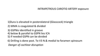 INTRAPETROUS CAROTID ARTERY exposure
1)Dura is elevated in posterolateral (Glasscock) triangle
2) MMA is coagulated & divided
3) GSPNis identified in groove
4) below & parallel to GSPN lies ICA
5) if needed GSPN can be divided
6) Drilling is done post. To V3 N.& medial to foramen spinosum
Danger of cochlear disruption
 