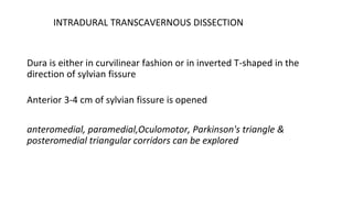 INTRADURAL TRANSCAVERNOUS DISSECTION
Dura is either in curvilinear fashion or in inverted T-shaped in the
direction of sylvian fissure
Anterior 3-4 cm of sylvian fissure is opened
anteromedial, paramedial,Oculomotor, Parkinson's triangle &
posteromedial triangular corridors can be explored
 
