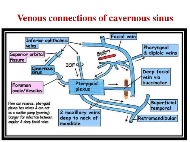 cavernous sinus thrombosis
