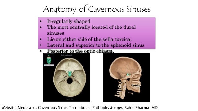 cavernous sinus thrombosis