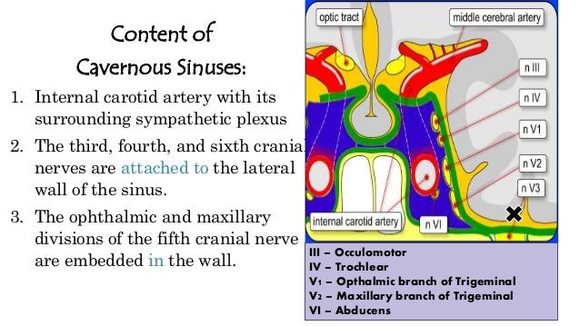cavernous sinus thrombosis