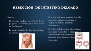RESECCIÓN DE INTESTINO DELGADO
Abierta
• El cirujano realiza un corte de 6 a 8
pulgadas (15 a 20 cm) en la parte media
de su abdomen.
• La parte afectada del intestino delgado
se localiza y se extirpa.
• Si queda suficiente intestino delgado
sano, los extremos se suturan o
engrapan. Esto se denomina
anastomosis.
• Si no hay suficiente intestino delgado
sano para reconectar, el cirujano hace
una abertura llamada estoma a través
de la piel de su abdomen llamado
ieostomia.
 