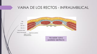 VAINA DE LOS RECTOS - INFRAUMBILICAL
No existe vaina
posterior del Recto
Piel
TCSC
Obl. Ext. >
Obl. Int. <
Transverso abd.
Fascia transversalis
Tejido Conect.
Extraperitoneal
Peritoneo parietal
 