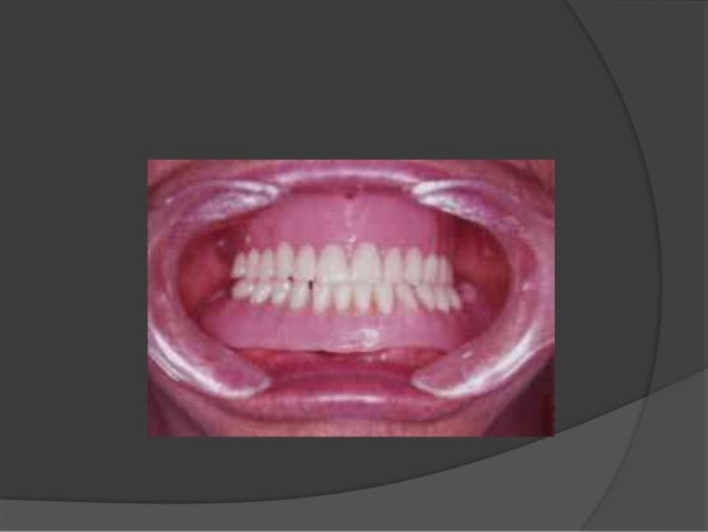 vestibulo y cavidad bucal cavidad bucal vestibulo y cavidad bucal cavidad bucal