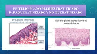 EPITELIO PLANO PLURIESTRATIFICADO
PARAQUERATINIZADO Y NO QUERATINIZADO
 