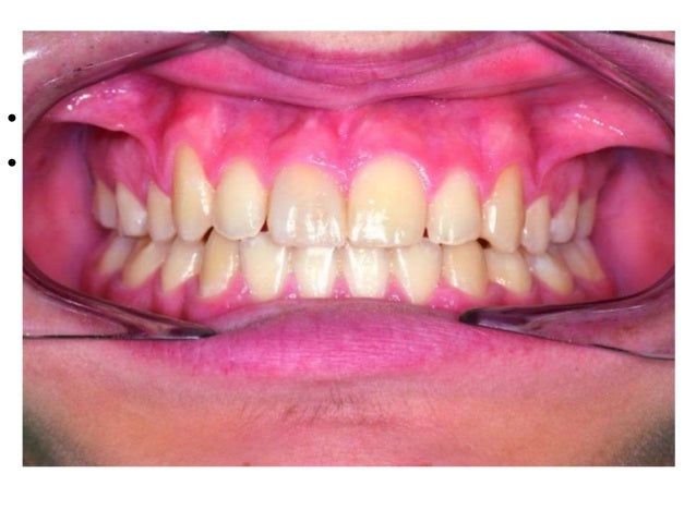 vestibulo y cavidad bucal cavidad bucal vestibulo y cavidad bucal cavidad bucal