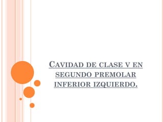 CAVIDAD DE CLASE V EN
SEGUNDO PREMOLAR
INFERIOR IZQUIERDO.

 