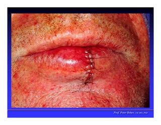 Prof. Peter Reher, CD, MSc, PhD
Prof. Peter Reher, CD, MSc, PhD
 