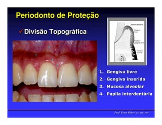 Periodonto de Proteção
              Proteção

  Divisão Topográfica
          Topográfica

         3

     2
             1
                 4

                        1. Gengiva livre
                        2. Gengiva inserida
                        3. Mucosa alveolar
                        4. Papila interdentária



                              Prof. Peter Reher, CD, MSc, PhD
                              Prof. Peter Reher, CD, MSc, PhD
 