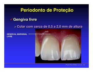Periodonto de Proteção
                         Proteção
     Gengiva livre
        Colar com cerca de 0,5 a 2,0 mm de altura
        Colar com cerca de 0,5 a 2,0 mm de altura

GENGIVAL MARGINAL
LIVRE




                                      Prof. Peter Reher, CD, MSc, PhD
                                      Prof. Peter Reher, CD, MSc, PhD
 