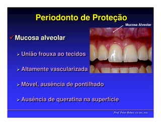 Periodonto de Proteção
                    Proteção
                                           Mucosa Alveolar



Mucosa alveolar

 União frouxa ao tecidos
 União frouxa ao tecidos

 Altamente vascularizada
 Altamente vascularizada

 Móvel, ausência de pontilhado
 Móvel, ausência de pontilhado

 Ausência de queratina na superfície
 Ausência de queratina na superfície

                                 Prof. Peter Reher, CD, MSc, PhD
                                 Prof. Peter Reher, CD, MSc, PhD
 
