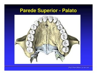 Parede Superior - Palato




                    Prof. Peter Reher, CD, MSc, PhD
                    Prof. Peter Reher, CD, MSc, PhD
 