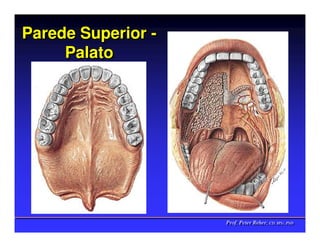 Parede Superior -
     Palato




                    Prof. Peter Reher, CD, MSc, PhD
                    Prof. Peter Reher, CD, MSc, PhD
 