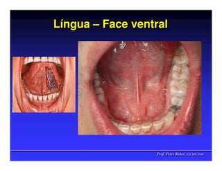Língua – Face ventral
Língua




                  Prof. Peter Reher, CD, MSc, PhD
                  Prof. Peter Reher, CD, MSc, PhD
 