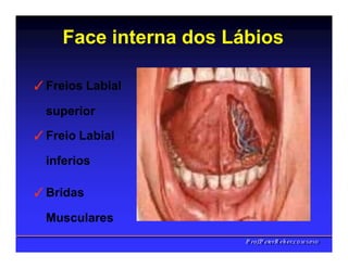 Face interna dos Lábios
✓Freios Labial
superior
✓Freio Labial
inferios
✓Bridas
Musculares
PPrrooff..PPeetteerrRReehheerr,,C
C
D
D
,
,
M
M
S
S
c
c
,
,
P
P
h
h
D
D
 