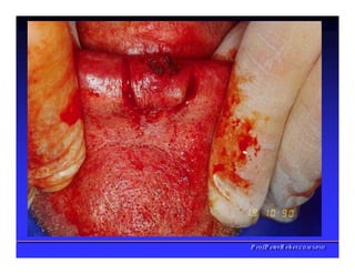 Vascularização do Lábio
✓Artérias labias
PPrrooff..PPeetteerrRReehheerr,,C
C
D
D
,
,
M
M
S
S
c
c
,
,
P
P
h
h
D
D
 