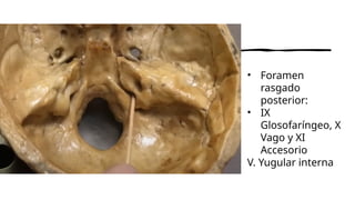 Formane Rasgado Cavidades- Cirujano dentista. Huesos de la cara. cráneo y neurocráneo ...