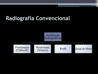 Radiografia Convencional
Incidências
Radiográficas
Frontonaso
(Caldwell)
Mentonaso
(Waters)
Perfil Axial de Hirtz
 