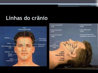 Linhas do crânio
• - Auxiliam no posicionamento em exames de
crânio e face.
 