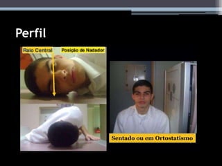 Perfil
Sentado ou em Ortostatismo
 
