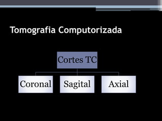 Tomografia Computorizada
Cortes TC
Coronal Sagital Axial
 