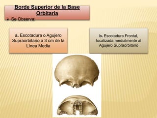 Borde Superior de la Base
Orbitaria
 Se Observa:
a. Escotadura o Agujero
Supraorbitario a 3 cm de la
Línea Media
b. Escotadura Frontal,
localizada medialmente al
Agujero Supraorbitario
 