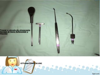 ETTIANA DINAS IQ USC
Trocar y cánula de sinoscopia
Acceso al Seno Esfenoidal y
Maxilar
 