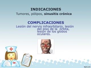 INDICACIONES
Tumores, pólipos, sinusitis crónica
COMPLICACIONES
Lesión del nervio infraorbitario, lesión
del piso de la órbita,
lesión de los globos
oculares.
 