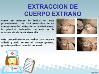 EXTRACCION DE
CUERPO EXTRAÑO
como su nombre lo indica en este
procedimiento se hará extracción de un
cuerpo extraño dentro de la cavidad nasal,
la principal indicación de este es la
obstrucción de la vía aérea alta.
este procedimiento se realiza con técnica
abierta y solo se usa el campo general,
guantes y el instrumental necesario.
 