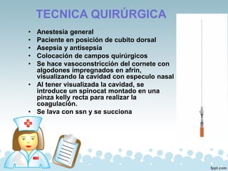 TECNICA QUIRÚRGICA
• Anestesia general
• Paciente en posición de cubito dorsal
• Asepsia y antisepsia
• Colocación de campos quirúrgicos
• Se hace vasoconstricción del cornete con
algodones impregnados en afrin,
visualizando la cavidad con especulo nasal
• Al tener visualizada la cavidad, se
introduce un spinocat montado en una
pinza kelly recta para realizar la
coagulación.
• Se lava con ssn y se succiona
 